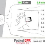 Zoll PocketCPR