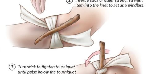 Domina el Uso del Torniquete Improvisado