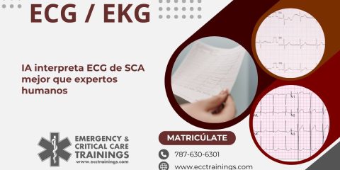 IA interpreta ECG de SCA mejor que expertos humanos