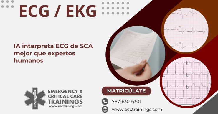 IA interpreta ECG de SCA mejor que expertos humanos