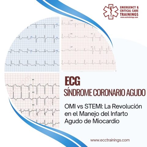 OMI vs STEMI: La Revolución en el Manejo del Infarto Agudo de Miocardio