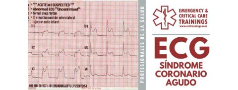 ECG: Síndrome Coronario Agudo