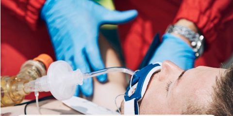 Intubación Endotraqueal versus Supraglóticos en Paro Cardíaco con Ritmo No-Desfibrilable: Evidencia, Tecnología y Formación Vital