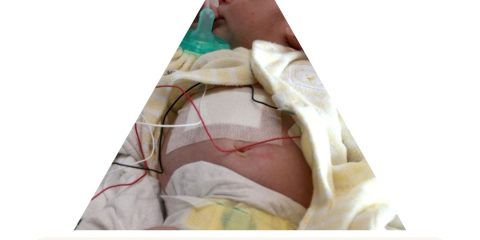 Triángulo de Evaluación Pediátrica: Clave para Salvar Vidas Infantiles en Emergencias