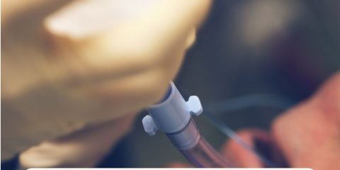 intubación en secuencia rápida aumenta la probabilidad de éxito al primer intento