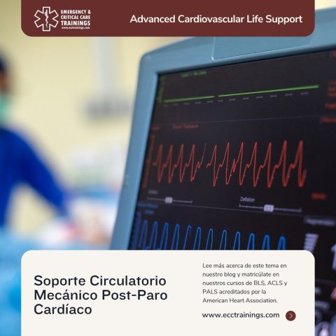 Soporte Circulatorio Mecánico Post-Paro Cardíaco: Claves para la Supervivencia y el Rol Crítico del Entrenamiento ACLS