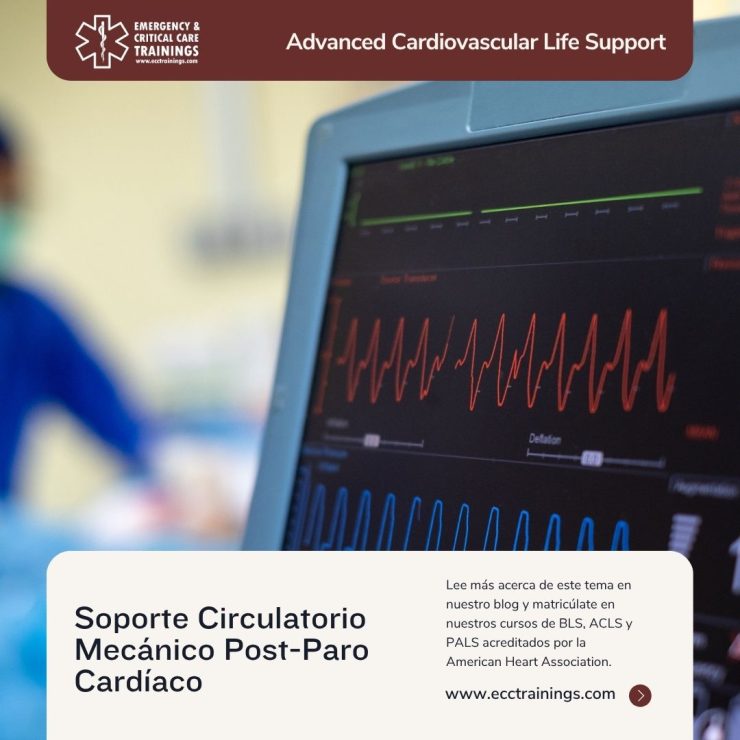 Soporte Circulatorio Mecánico Post-Paro Cardíaco: Claves para la Supervivencia y el Rol Crítico del Entrenamiento ACLS