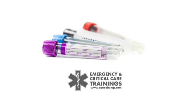 curso de canalización